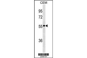 Image no. 1 for Mouse anti-Human IgA (AA 150-178) antibody (ABIN1480665) (Mouse anti-Human IgA (AA 150-178) Antibody)