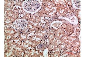 Immunohistochemical analysis of paraffin-embedded human-kidney, antibody was diluted at 1:200 (HMMR antibody  (AA 280-340))