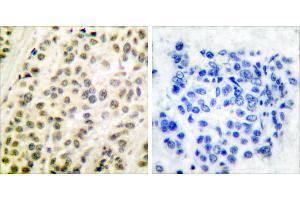 Peptide - +Immunohistochemical analysis of paraffin-embedded human breast carcinoma tissue using DP-1 antibody. (TGM4 antibody)