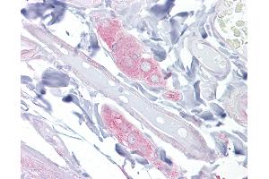 Human Small Intestine, Submucosal Plexus: Formalin-Fixed, Paraffin-Embedded (FFPE). (DPYSL3 antibody  (Internal Region))