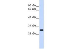 Image no. 1 for anti-CTD Nuclear Envelope Phosphatase 1a (CTDNEP1A) (C-Term) antibody (ABIN6740996)
