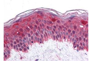 Human Skin: Formalin-Fixed, Paraffin-Embedded (FFPE) (LHX8 antibody)