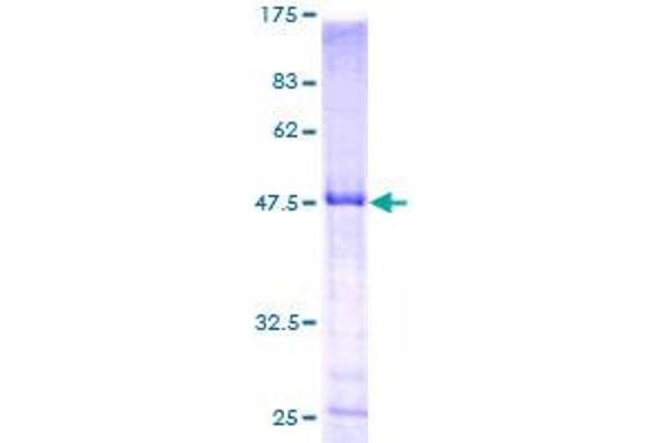 HLA-DPB1 Protein (AA 30-258) (GST tag)