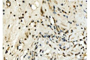 IHC analysis of EXOSC8 using anti-EXOSC8 antibody (ABIN7601850). (EXOSC8 antibody  (AA 49-216))