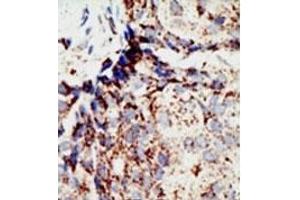 Image no. 1 for anti-BRCA1 Associated Protein-1 (Ubiquitin Carboxy-terminal Hydrolase) (BAP1) (N-Term) antibody (ABIN357594) (BAP1 antibody  (N-Term))