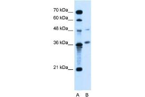 Human Jurkat; WB Suggested Anti-ARMCX6 Antibody Titration: 5. (ARMCX6 antibody  (N-Term))