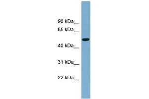 WB Suggested Anti-SLC2A8 Antibody Titration:  0. (SLC2A8 antibody  (Middle Region))