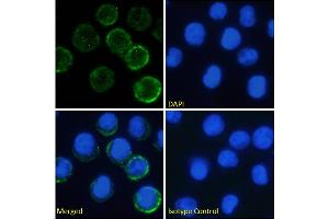 Immunofluorescence staining of fixed U937 cells with anti-IL-6 receptorantibody rhPM-1 (Tocilizumab). (Recombinant IL-6R (Tocilizumab Biosimilar) antibody)