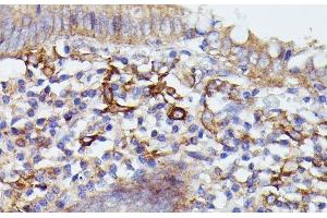 Immunohistochemistry of paraffin-embedded Human appendix using SNAP23 Polyclonal Antibody at dilution of 1:100 (40x lens). (SNAP23 antibody)