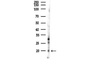 anti-Chromosome 20 Open Reading Frame 27 (C20ORF27) antibody