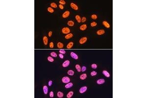 Immunofluorescence analysis of U-2 OS cells using hnRNP K Rabbit mAb (ABIN7267634) at dilution of 1:100 (40x lens). (HNRNPK antibody)
