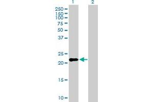 Western Blot analysis of IFNK expression in transfected 293T cell line by IFNK MaxPab polyclonal antibody. (IFNK antibody  (AA 1-207))