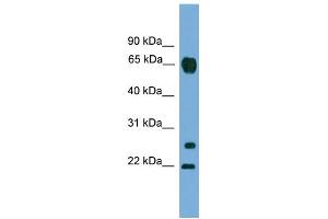 WB Suggested Anti-MMP26 Antibody Titration: 0. (MMP26 antibody  (C-Term))