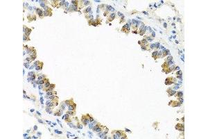 Immunohistochemistry of paraffin-embedded Mouse lung using TICAM1 Polyclonal Antibody at dilution of 1:100 (40x lens). (TICAM1 antibody)
