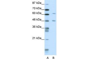 WB Suggested Anti-NAB2 Antibody Titration:  1. (NAB2 antibody  (N-Term))