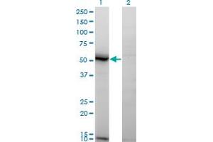 Western Blot analysis of ASAH1 expression in transfected 293T cell line by ASAH1 monoclonal antibody (M02), clone 1A7. (ASAH1 antibody  (AA 25-124))