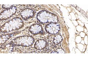 Detection of IFNb in Human Colon Tissue using Monoclonal Antibody to Interferon Beta (IFNb) (IFNB1 antibody)