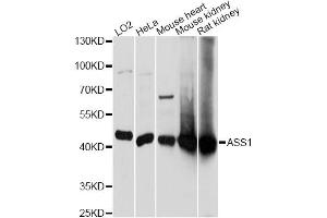 Western blot analysis of extracts of various cell lines, using ASS1 antibody. (ASS1 antibody)