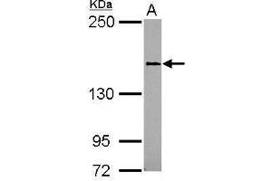 WB Image Sample (30 ug of whole cell lysate) A: 293T 5% SDS PAGE antibody diluted at 1:1000