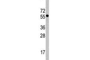 Western blot analysis of CDC6 antibody in Ramos lysate. (CDC6 antibody  (AA 32-61))