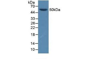 Detection of GFRa1 in Porcine Brain Tissue using Polyclonal Antibody to Glial Cell Line Derived Neurotrophic Factor Receptor Alpha 1 (GFRa1) (GFRA1 antibody  (AA 239-350))