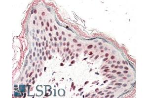 ABIN1781814 (5µg/ml) staining of paraffin embedded Human Skin. (SRCAP antibody  (AA 309-322))