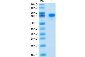 PD-L1 Protein (AA 19-238) (Fc Tag)