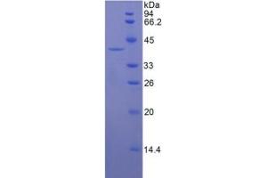 SDS-PAGE analysis of Human Keratin 16 Protein. (KRT16 Protein)
