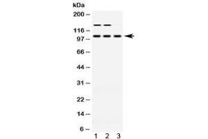 Western blot testing of 1) rat skeletal muscle, 2) mouse skeletal muscle and 3) human HT080 lysate with ACTN3 antibody at 0.
