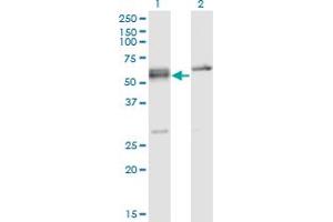 Western Blot analysis of SFRS6 expression in transfected 293T cell line by SFRS6 monoclonal antibody (M02), clone 5G6. (SFRS6 antibody  (AA 1-75))