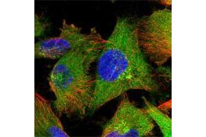 Immunofluorescent staining of human cell line U-251 MG shows positivity in plasma membrane, cytoplasm & golgi apparatus. (ZC3HAV1 antibody)
