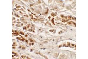 Immunohistochemistry of NKX2-2 in human kidney tissue with NKX2-2 antibody at 2. (Nkx2-2 antibody  (Middle Region))