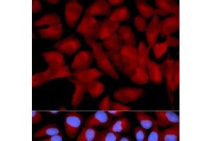 Immunofluorescence analysis of U2OS cells using EIF5A Polyclonal Antibody (EIF5A antibody)