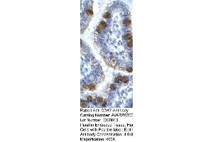 Immunohistochemistry (IHC) image for anti-Cyclin-Dependent Kinase 7 (CDK7) (C-Term) antibody (ABIN406738) (CDK7 antibody  (C-Term))