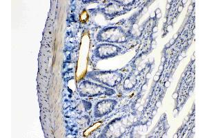 ANGPTL2 was detected in paraffin-embedded sections of rat intestine tissues using rabbit anti- ANGPTL2 Antigen Affinity purified polyclonal antibody (Catalog # ) at 1 µg/mL. (ANGPTL2 antibody  (Middle Region))