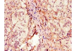 Immunohistochemistry of paraffin-embedded human adrenal gland tissue using ABIN7162949 at dilution of 1:100 (ACOX1 antibody  (AA 113-273))