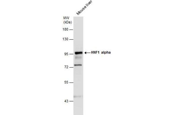 HNF1A antibody