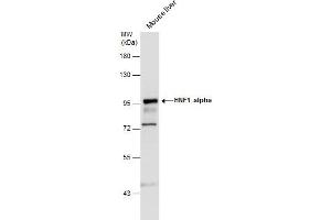WB Image HNF1 alpha antibody [N1N3] detects HNF1 alpha protein by western blot analysis.