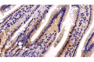 Immunohistochemistry (IHC) image for anti-Complement Component 1, Q Subcomponent Binding Protein (C1QBP) (AA 71-278) antibody (ABIN7432319)