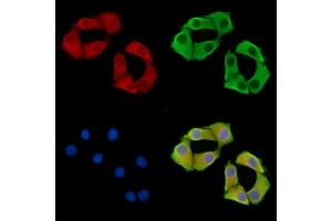 ABIN7095844 and ABIN7099906 staining Hela cells by IF/ICC. (B4GALNT3 antibody)