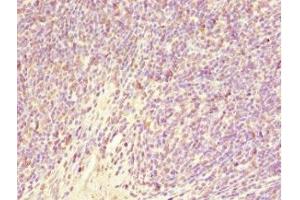 Immunohistochemistry of paraffin-embedded human thymus tissue using ABIN7153505 at dilution of 1:100 (GABRR1 antibody  (AA 365-465))