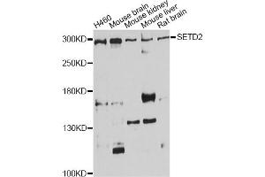 Western blot analysis of extracts of various cell lines, using SETD2 antibody (ABIN1874744) at 1:1000 dilution.