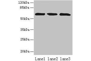 Western blot All lanes: ZNF554 antibody at 5 μg/mL Lane 1: K562 whole cell lysate Lane 2: U937 whole cell lysate Lane 3: A549 whole cell lysate Secondary Goat polyclonal to rabbit IgG at 1/10000 dilution Predicted band size: 61 kDa Observed band size: 61 kDa (ZNF554 antibody  (AA 239-538))