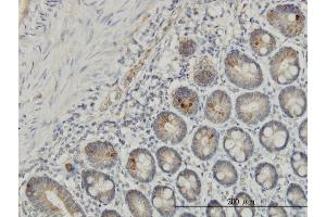 Immunoperoxidase of monoclonal antibody to IL1F7 on formalin-fixed paraffin-embedded human small Intestine. (IL-37 antibody  (AA 1-218))