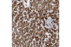 Immunohistochemical staining of human liver with AGXT polyclonal antibody  shows strong cytoplasmic positivity in granular pattern in hepatocytes at 1:1000-1:2500 dilution. (AGXT antibody)
