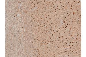 ABIN6267554 at 1/100 staining mouse brain tissue sections by IHC-P.