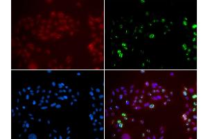 Immunofluorescence analysis of GFP-RNF168 transgenic U2OS cell using XPA antibody. (XPA antibody)