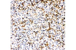 IHC analysis of MCP1/CCL2 using anti-MCP1/CCL2 antibody (ABIN3042598). (CCL2 antibody  (AA 24-99))