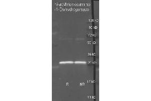 Goat anti N-acylmanosamino-1-Dehydrogenase antibody ( was used to detect purified N-acylmanosamino-1-Dehydrogenase under reducing (R) and non-reducing (NR) conditions.