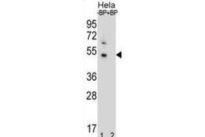 Western Blotting (WB) image for anti-DnaJ (Hsp40) Homolog, Subfamily B, Member 6 (DNAJB6) antibody (ABIN2996781) (DNAJB6 antibody)